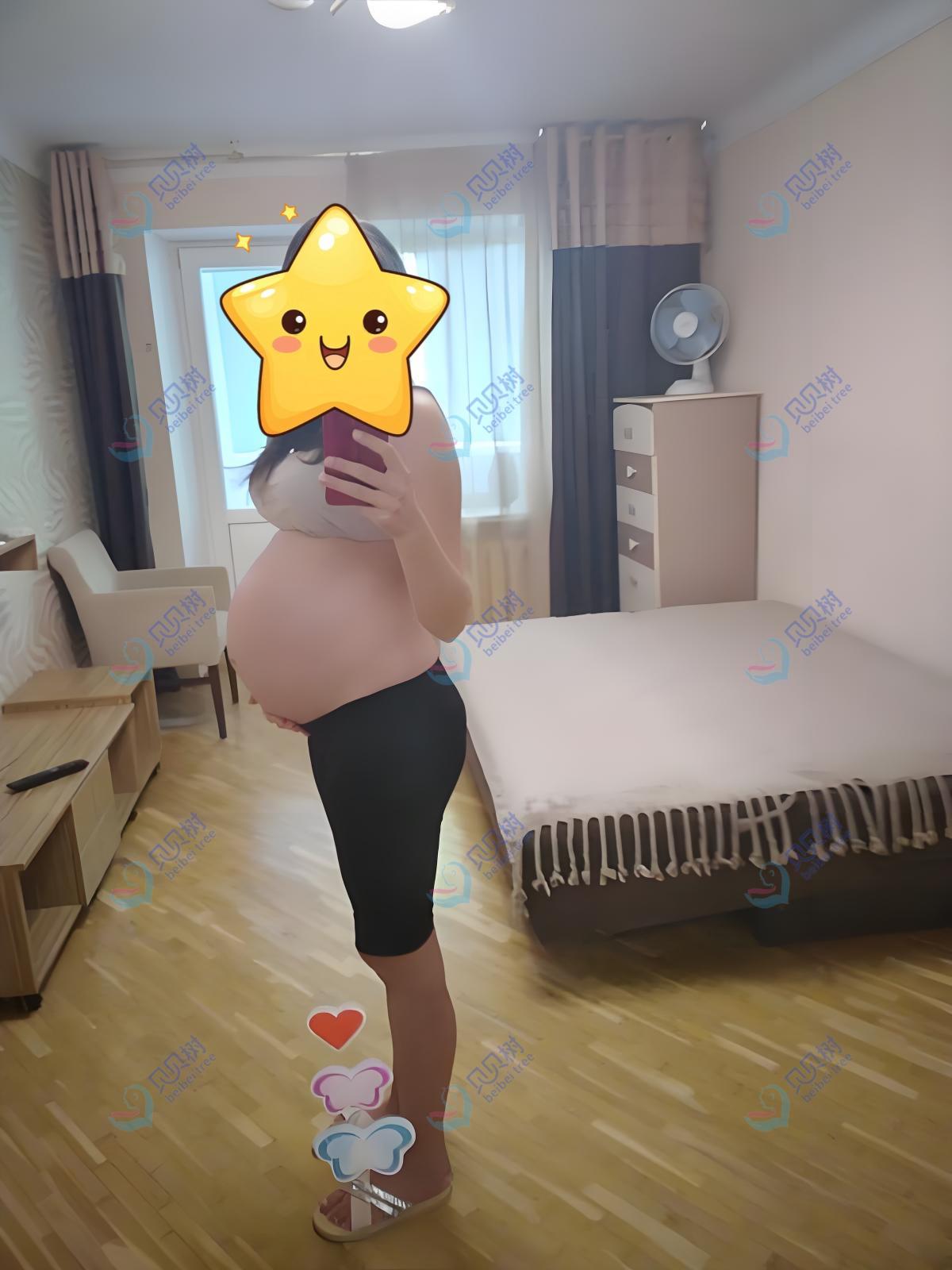 贝贝树试管服务孕产生活照案例 - 右侧图 