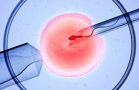 In Vitro Fertilization (IVF)
